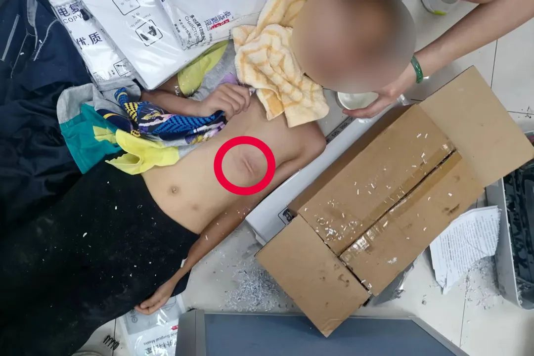 碎纸机&ldquo;咬住&rdquo;男童腹部，公安消防火速施救