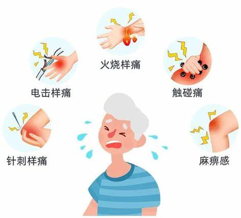 得了带状疱疹？别怕！早期规范治疗大大降低患后遗症风险&rarr;