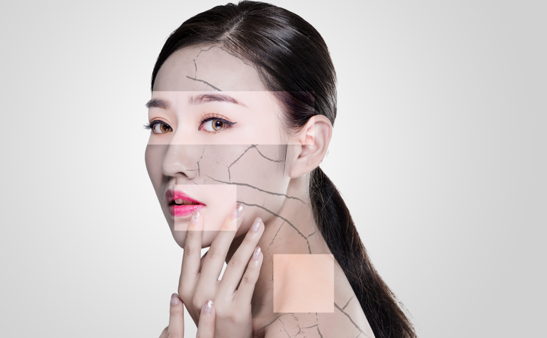 @干皮星人，掌握这几招，皮肤水润一整个冬季